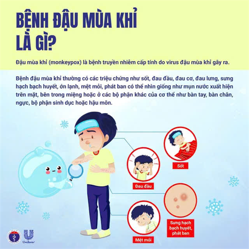 Chủ động phòng, chống bệnh Đậu mùa khỉ